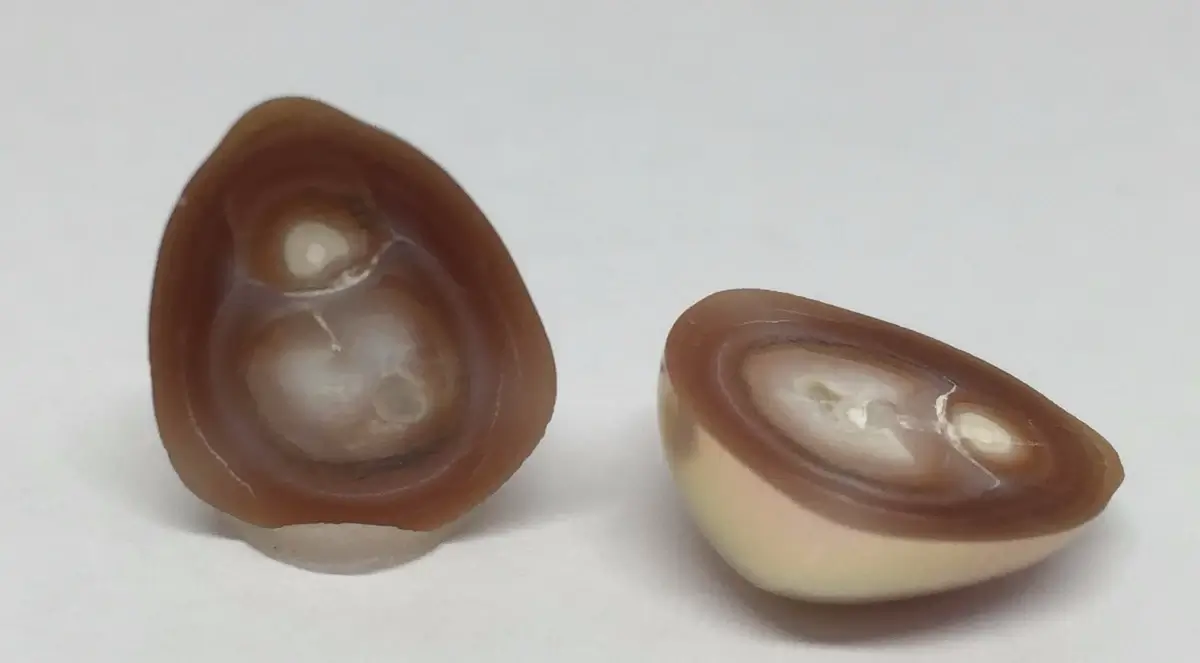 Cross section of a cultured freshwater pearl